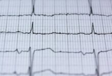 stellar fusion energy source